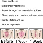 AnnieCare Instant Anti-Itch Detox Products, Annie Care Capsulas, Firming Repair & Pink and Tender Natural Capsules, Annie Care Capsulas (8Bag)
