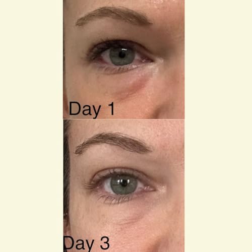 Grass-Fed Beef Tallow Eye Cream Infused with Coffee Beans - Rosehip Oil, Vitamin E - All Natural & Organic - Chemical Free - Non Toxic - Whipped - 1 oz Amber Glass Jar