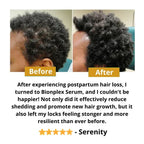 BIONPLEX 100% Organic Hair Growth Serum For Thinning Hair Loss - More Bottles:: 1 Pics