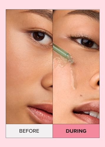 I DEW CARE Korean Heartleaf Serum for blemish prone skin- Juicy Kitten | Green Juice for Face, Glass Skin with Niacinamide, Kale, Moringa Seed, Willow Bark Extarct, 1.01 FL Oz