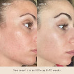 Barefaced Toning Pads (60 count) Exfoliating Face Pads with 2% Glycolic Acid & Salicylic Acid - Helps with Brightening & Cleansing Skin, Clears Pores, Reduces Fine Lines and Wrinkles, Resurfacing Pads