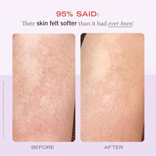 First Aid Beauty - KP Bump Eraser Body Scrub with 10% AHA, Keratosis Pilaris Exfoliater with Glycolic and Lactic acids, Helps Reduce Chicken Skin Bumps, Safe for Sensitive Skin, Strawberry Scent, 2 oz