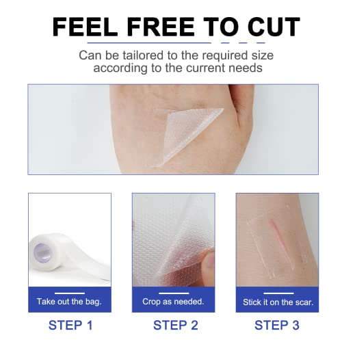 Silicone Scar Sheets - Gel Silicone Scar Tape (1.6” x 120”), Invisible Medical Grade Scar Silicone Strips, Transparent Removal Scar Patches for Keloids, Burn, C-Section, Acne
