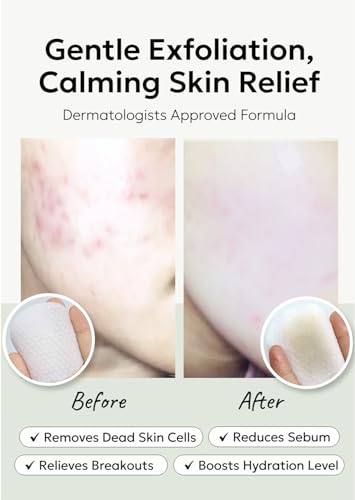 celimax Ji.Woo.Gae Pore+Dark Spot Brightening Pad (40 Pads) + Ji.Woo.Gae Heartleaf BHA Peeling Pad (60 pads) Bundle