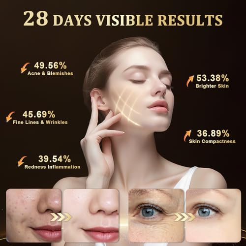 Red Light Therapy for Face, LED Face Mask Light Therapy, Red Light Therapy Mask for Acne, Wrinkles and Skin Rejuvenation, 320 LEDs, 3 Modes, 10-Min Auto Off, Eye Protection Included
