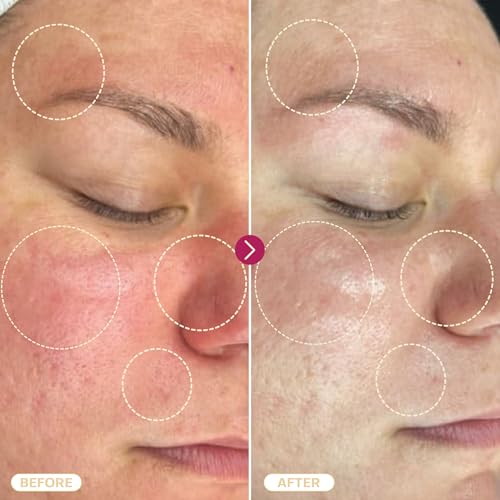 BASE LABORATORIES Hypochlorous Acid Spray for Face & Skin | 8oz | Magic Facial Spray Daily Skin Repair Solution for Sensitive Skin, Redness, Irritations, Eczema | Hypochlrous HOCL Molecule Spray | 2PK