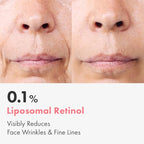 Repair Retinol Cream, Liposomal Retinol 0.1%, Bakuchiol, Retinal, niacinamide, Anti Aging for Face, Eye, Fine Lines & Wrinkles Treatment, Pure Vitamin A, Korean Skincare, 50g, 1.76 oz.