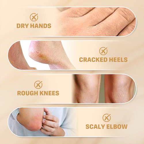 60% Urea Cream with 2% Salicylic Acid, Urea Cream 60 Percent For Feet Maximum Strength, Urea Lotion For Feet and Hand for Rough, Dry, Thick & Cracked Skin, Deep Moisturizing and Callus Removing-150g