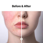 MAY COOP Moisture Essence Toner for Anti-Aging Korean Skincare 150mL – Hydrating Skin with Wildcrafted Centella Asiatica, Rice Water & Birch Bark – Nourishing – Fast-Absorbing