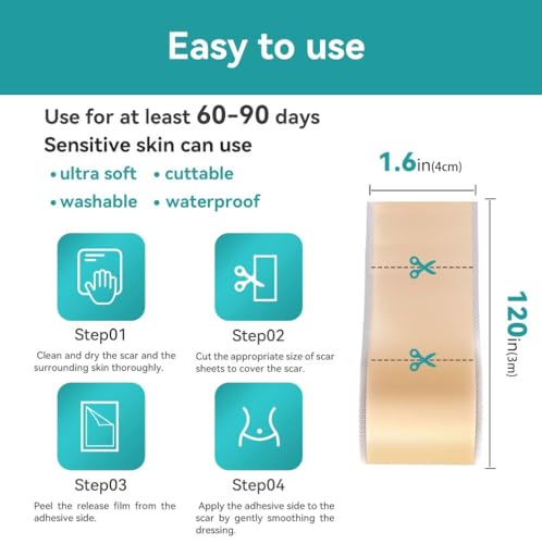 Dimora Medical Grade Silicone Scar Sheets - Ultra Soft Silicone Scar Tape (1.6”x120" Roll), Waterproof Scar Treatment for Surgical Scars, C Section, Tummy Tuck, Keloid Treatment