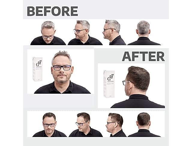 GR-7 Anti Grey Hair 125 ml - Repigmentation Hair - Shampoo Against Grey Hair 1 pieces - Shampoo Grey - Anti Grey Hair - Grey Hair