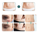 Losveo Silicone Scar Sheets For Face Wrinkles, 1.6”x 120”/3m Collagen Scar Tape Strips for Face,Medical Grade Silicone Scar Sheets for Surgical Scars,C-Section, Burn, Scars- Reusable(1box/3m)