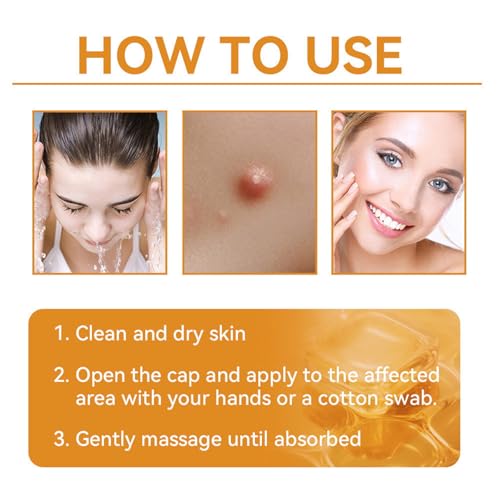 BBOJI 7-Day Multi-Effect All-in-One Skincare Cream, 2025 New Professional Bee Venom Cream, BOJI Bee Venom Skin Treatment Cream, Repair, moisturize and lift 3 in 1, for All Skin Types (1 Bottle)