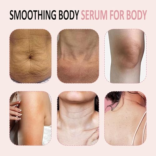 B Glossy Body Serum for Wrinkles, B Glossy Smoothing Body Serum for Wrinkles, Anti-Aging & Wrinkle Smoothing Formula, Infused with Hyaluronic Acid, Glycerin, Vitamin E, Hydrating & Firming 3.38FL.OZ