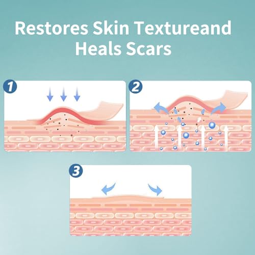Losveo Silicone Scar Sheets for Face Wrinkles, Medical Grade Silicone Scar Sheets(1.6”x 120” Roll-3M) for Surgical Scars, C-Section, Burn, and Acne Scars- Reusable Scar Removal Strips