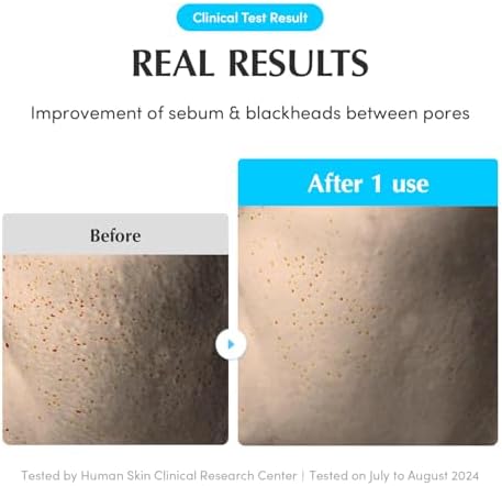Swimming Pool Toner Pads - Dual-Textured Facial Toner Pads for Pore Care and Gentle Exfoliation | Boosted Hydration with Hyaluronic Acid | Korean Toner Pads for Face (70 Pads)