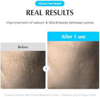 Swimming Pool Toner Pads - Dual-Textured Facial Toner Pads for Pore Care and Gentle Exfoliation | Boosted Hydration with Hyaluronic Acid | Korean Toner Pads for Face (70 Pads)