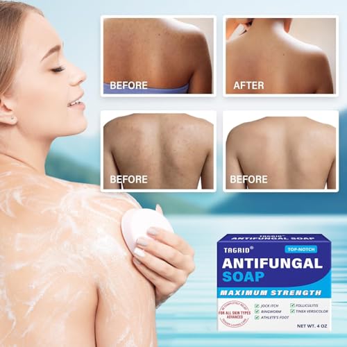 TAGRID Antifungal Soap Kit, Tea Tree Soap, Antifungal Face Wash, Antibacterial Treatment for Body Jock Itch, Ringworm, Athlete's Foot, Folliculitis, Tinea Versicolor, Fungal Acne Treatment (TOP-NOTCH)