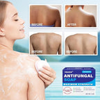 TAGRID Antifungal Soap Kit, Tea Tree Soap, Antifungal Face Wash, Antibacterial Treatment for Body Jock Itch, Ringworm, Athlete's Foot, Folliculitis, Tinea Versicolor, Fungal Acne Treatment (TOP-NOTCH)