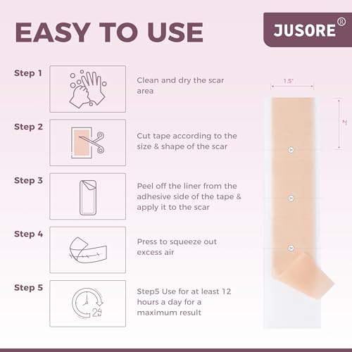 Silicone Scar Sheets - (1.6" x 120" Roll) Advanced Professional Medical Treatment for Scar Reduction, Painless Scar Removal Sheets for Surgical Scars, C-Section, Burns, Keloids