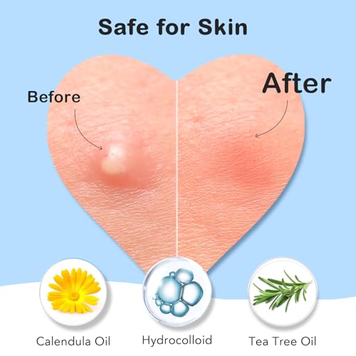 Pimple Patches for Face 7 Sizes Day and Night Acne Patches Heart Zit Patches Cute Spot Stickers with Tea Tree & Centella Oil, Strong Adhesion Zit Covers (412 Count)