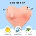 Pimple Patches for Face 7 Sizes Day and Night Acne Patches Heart Zit Patches Cute Spot Stickers with Tea Tree & Centella Oil, Strong Adhesion Zit Covers (412 Count)
