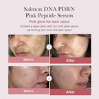 medicube Calm and Clear Skin Duo: medicube Mini Booster Pro Pink and Salmon DNA PDRN Pink Peptide Serum