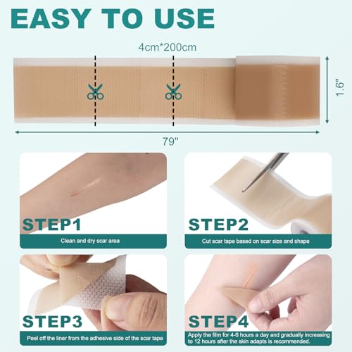 Silicone Scar Sheets, Silicone Scar Tape(1.6"x 79"), Professional Scar Removal Treatment, Reusable Silicone Scar Strips for Keloids, Surgeries Scars, C-sections, and Burns