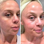 Retinol Gel 0.1 Vitamin A Repairs Fine Lines & Wrinkles, Scar Treatment, Age and Sun Spots, Anti-Aging Formula Gel 20 Grams