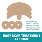 Silicone Scar Tape, 8 Pcs Medical Grade Breast Silicone Scar Sheets, Reusable Scar Tape for Surgical Scars