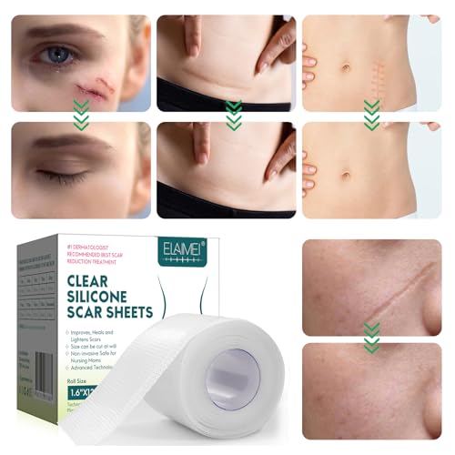 Silicone Scar Sheets, Clear Silicon Gel Scar Sheets, Invisible Scar Tape(1.6” x 120”Roll-3M), Scar Strips for Surgical Scars, Medical Grade, Scar Removal Sheets for C-Section, Breast, Keloid et.