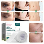 Silicone Scar Sheets, Clear Silicon Gel Scar Sheets, Invisible Scar Tape(1.6” x 120”Roll-3M), Scar Strips for Surgical Scars, Medical Grade, Scar Removal Sheets for C-Section, Breast, Keloid et.