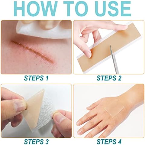 Silicone Scar Sheets (1.6” x 150”-3.8M), Medical Grade Soft Silicone Scar Tape, Strips, Roll - Keloid, C-Section, Surgical, Acne- Scars Removal Treatment, Painless Easy Removal, Reusable
