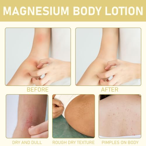 Neuropathy Cream, Magnesium Cream for Neuropathy, Nerve Relief Lotion for Feet Hand Nerve Neuropathy No Greasy Body Lotion Cream with Natrural Ingredients For Soothing Body Day Night, Lavender