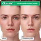 Dr.Jart+ Cicapair™ Sensitive Skin Serum Face Mask for Redness with Centella Asiatica | Sheet Mask | Korean Skin Care