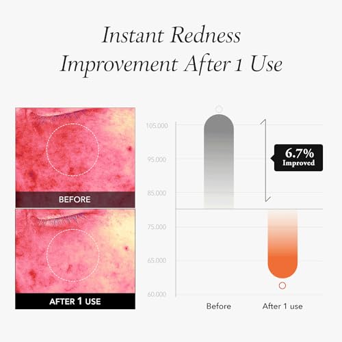 APRILSKIN Carrotene IPMP™ Instant Calming Serum Toner Pads | 5-Minute Cooling Serum Pads | Vegan, Cruelty-Free | Non-comedogenic | Toner-Serum-Sheet Mask All-in-one | Korean Skin Care, 80 Pads