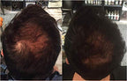 Zenagen Revolve Thickening Hair Loss Treatment for Men