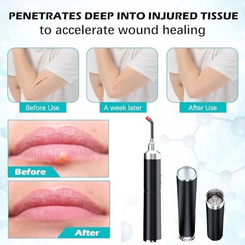 Red Light Therapy,Cold Sores Treatment&Fever Blister, Infrared Light Therapy for Lips Mouth Nose Ear Knee Feet Hands Joint Muscle Nerve Pain Relief Red Light Therapy for Face with Removable Tip