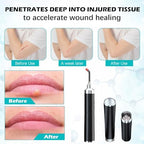 Red Light Therapy,Cold Sores Treatment&Fever Blister, Infrared Light Therapy for Lips Mouth Nose Ear Knee Feet Hands Joint Muscle Nerve Pain Relief Red Light Therapy for Face with Removable Tip
