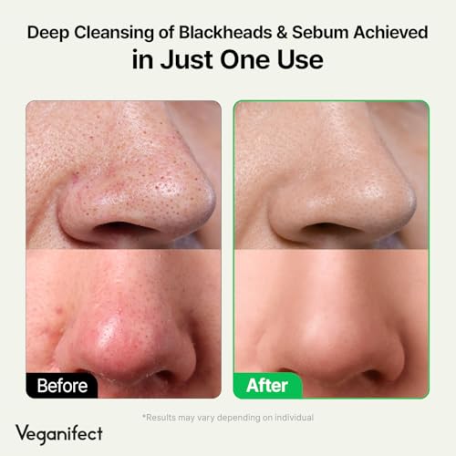 LHA Deep Cleansing Oil, Makeup, Blackhead and Whitehead Remover, Korean Skin Care, Vegan, 6.93 Fl Oz