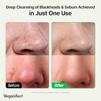 LHA Deep Cleansing Oil, Makeup, Blackhead and Whitehead Remover, Korean Skin Care, Vegan, 6.93 Fl Oz