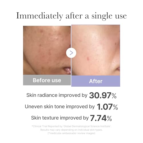 medicube Mini Booster Pro White | Affordable At-Home Facial Skin Care Tool for Beginners - Portable Glow Booster for Glass Skin, Boosting Skin Care Absorption, Skin care for teens, Korean Skin Care