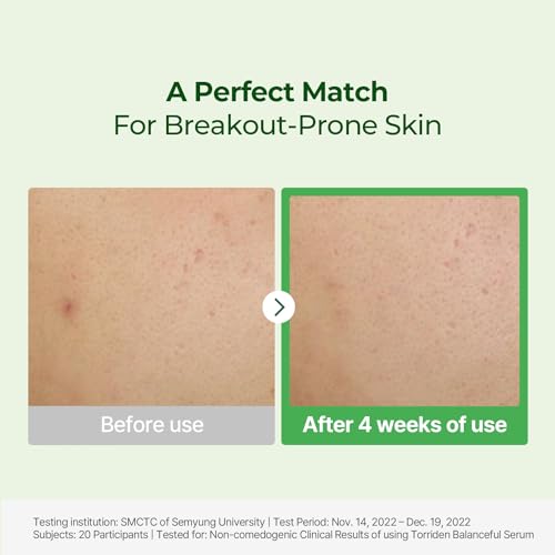 Torriden BALANCEFUL Serum 50ml (1.69 fl.oz.) | Instant Soothing and Balancing Care for Sensitive Skin | 5D CICA, Hydrolyzed Hyaluronic Acid, Panthenol | Korean Facial Serum