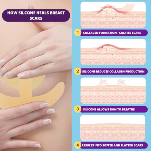 Breast Surgery Recovery Essentials - Silicone Scar Sheets for Comfort and Healing - Ideal for Post-Op Wear