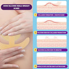 Breast Surgery Recovery Essentials - Silicone Scar Sheets for Comfort and Healing - Ideal for Post-Op Wear