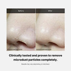 medicube Double Cleanser Duo for Facial Cleansing: Zero Pore Blackhead Deep Cleansing Oil and Zero Foam Cleanser