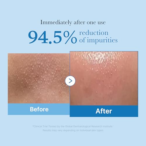 medicube Double Cleanser Duo for Facial Cleansing: Zero Pore Blackhead Deep Cleansing Oil and Zero Foam Cleanser