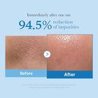 medicube Double Cleanser Duo for Facial Cleansing: Zero Pore Blackhead Deep Cleansing Oil and Zero Foam Cleanser