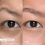 DRMTLGY Dark Circles Bundle - Medium: Luminous Eye Corrector SPF 41 & HPR Eye Cream