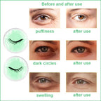 Face Eye Masks for Dark Circles and Puffiness, Migraines, Headache, Stress, Redness, Acne, Cooling Face Masks for Women Man, Hot Cold Use Ice Face Mask. (Green)